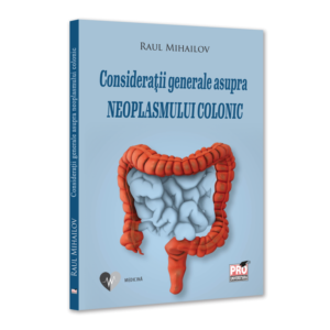 Consideratii generale asupra neoplasmului colonic